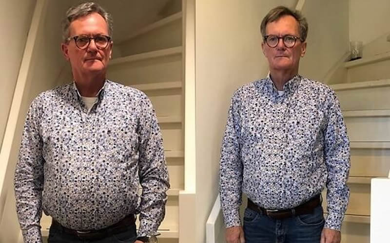 Barbara Before and After