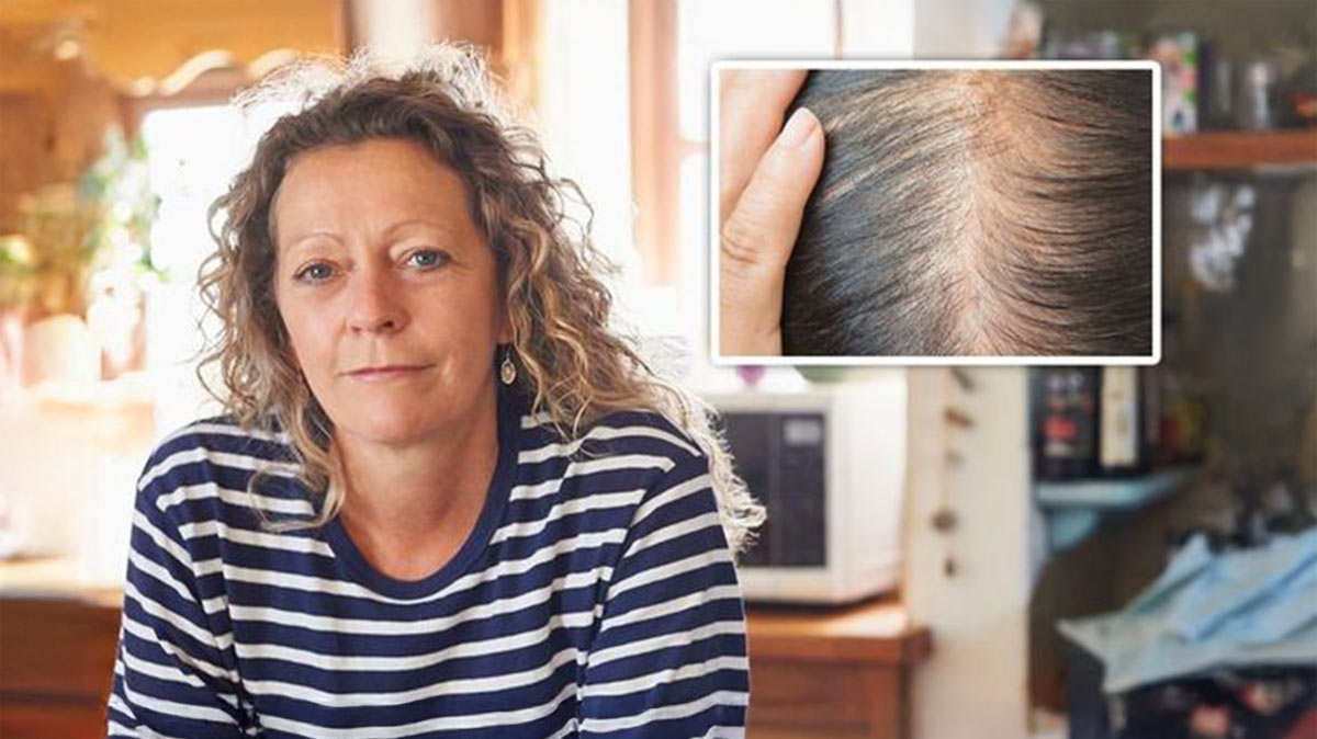 Woman concerned about hair loss