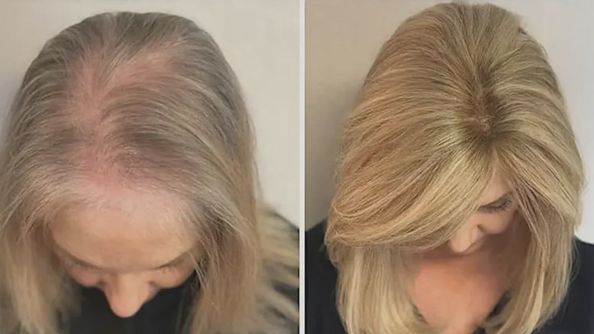 Client transformations